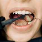 Close-up of a dental examination with modern equipment, showcasing oral hygiene maintenance.